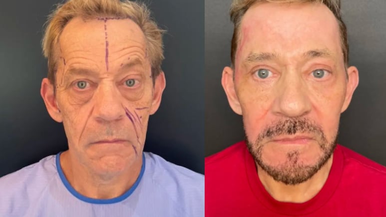 61-Year-Old Man's Incredible 43 Kg Weight Loss Proves It's Never Too Late 61-Year-Old Man's Incredible 43 Kg Weight Loss Proves It's Never Too Late