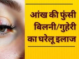 क्यों हो जाती है आंख की फुंसी/बिलनी/गुहेरी या Eye Stye , जानें इसके कारण, इलाज और बचाव क्यों हो जाती है आंख की फुंसी/बिलनी/गुहेरी या Eye Stye , जानें इसके कारण, इलाज और बचाव