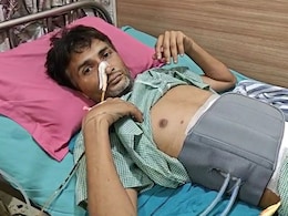 युवक के पेट से निकले एक एक करके 29 चम्मच और 19 टूथ ब्रश, देखकर डॉक्टर भी रह गए दंग युवक के पेट से निकले एक एक करके 29 चम्मच और 19 टूथ ब्रश, देखकर डॉक्टर भी रह गए दंग