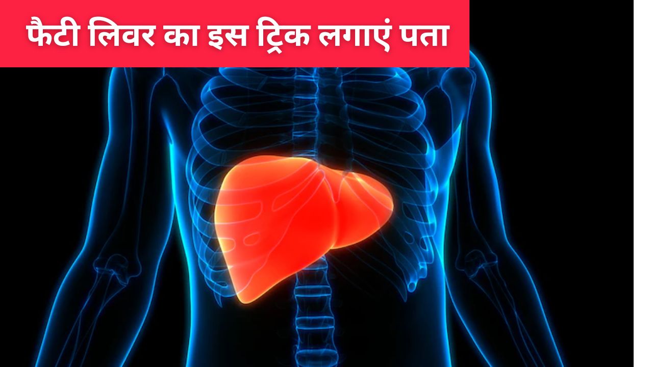 आपका फैटी लिवर है या नहीं घर पर इस तरीके से पता करें, डॉक्टर सरीन ने बताई ट्रिक्स