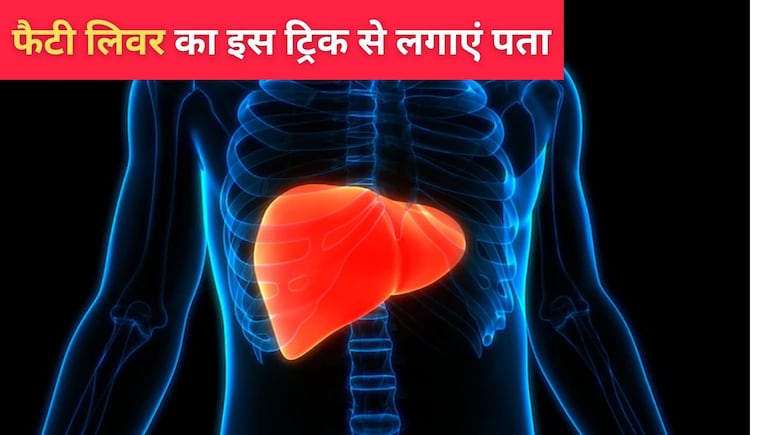 आपका फैटी लिवर है या नहीं घर पर इस तरीके से पता करें, डॉक्टर सरीन ने बताई ट्रिक्स