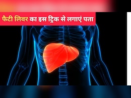 आपका फैटी लिवर है या नहीं घर पर इस तरीके से पता करें, डॉक्टर सरीन ने बताई ट्रिक्स आपका फैटी लिवर है या नहीं घर पर इस तरीके से पता करें, डॉक्टर सरीन ने बताई ट्रिक्स