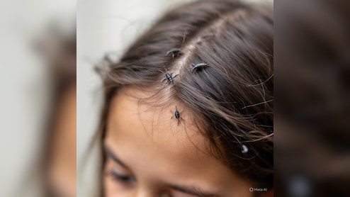 सिर की जुओं से हैं परेशान, तो नारियल तेल में ये चीज मिलाकर लगाएं, चुटकियों में गायब हो जाएंगी सारी जुएं