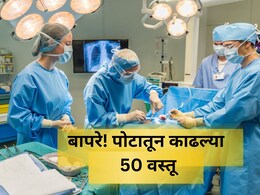 Shocking News: अरे देवा! तरुणाच्या पोटात 29 चमचे अन् 19 ब्रश; असं घडलं तरी कसं? डॉक्टरही हादरले