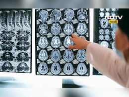 Health News: भारतात डेंजर रोगाची एण्ट्री ! थेट मेंदूवरच हल्ला, 61 रुग्ण आढळले 19 जणांचा मृत्यू