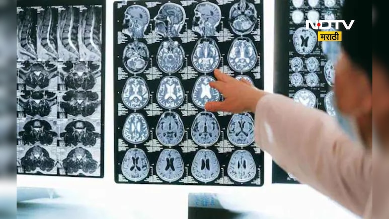 Health News: भारतात डेंजर रोगाची एन्ट्री! थेट मेंदुवरच हल्ला, 61 रुग्ण आढळले 19 जणांचा मृत्यू