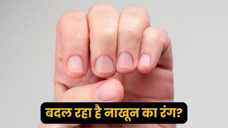 क्यों बदलने लगता है नाखूनों का रंग? इन बदलावों को न करें नजरअंदाज, लाइफस्टाइल पर दें ध्यान