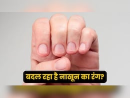 क्यों बदलने लगता है नाखूनों का रंग? इन बदलावों को न करें नजरअंदाज, लाइफस्टाइल पर दें ध्यान क्यों बदलने लगता है नाखूनों का रंग? इन बदलावों को न करें नजरअंदाज, लाइफस्टाइल पर दें ध्यान