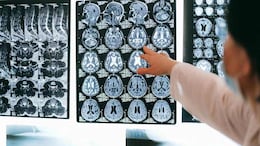 Study Reveals How The Brain Evolves Through Five Distinct Stages