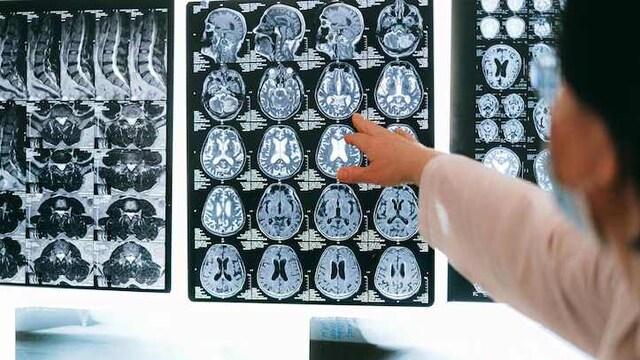 Study Reveals How The Brain Evolves Through Five Distinct Stages