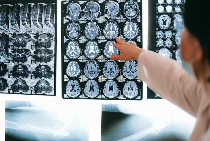 Study Reveals How The Brain Evolves Through Five Distinct Stages