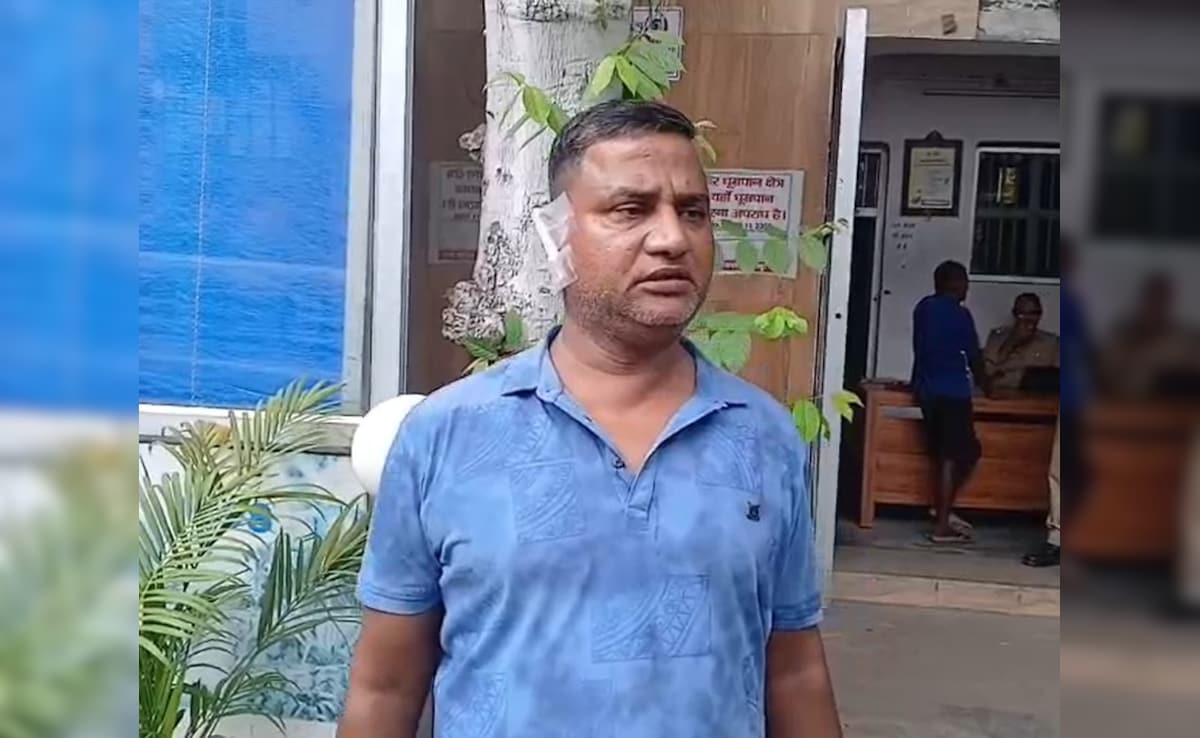 Woman Bites Off Husband's Ear After Fight At Home In UP