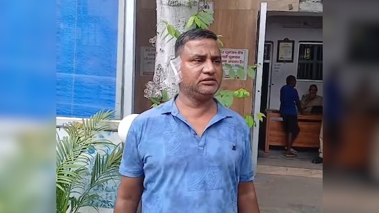 Woman Bites Off Husband