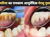 पायरिया कैसे ठीक करें? Dr. Deepak Kumar ने बताया दांत की सभी समस्याओं का एक कारगर घरेलू उपाय
