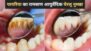 मुंह की बदबू, मसूड़ों से खून आना, Doctor ने बताया पायरिया का फिटकरी से बनने वाला कारगर घरेलू इलाज