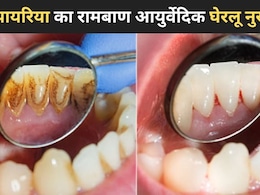 मुंह की बदबू, मसूड़ों से खून आना, Doctor ने बताया पायरिया का फिटकरी से बनने वाला कारगर घरेलू इलाज मुंह की बदबू, मसूड़ों से खून आना, Doctor ने बताया पायरिया का फिटकरी से बनने वाला कारगर घरेलू इलाज