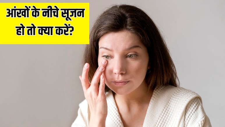 आंखों के नीचे सूजन होने पर क्या करें? डॉक्टर ने बताए Puffy Eyes से छुटकारा पाने के 5 सबसे असरदार तरीके