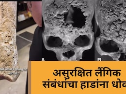 Syphilis: केवळ एड्सच नाही, तर हा लैंगिक आजार तुमच्या हाडांचीही करतो राख! वेळीच ओळखा ही लक्षणं... Syphilis: केवळ एड्सच नाही, तर हा लैंगिक आजार तुमच्या हाडांचीही करतो राख! वेळीच ओळखा ही लक्षणं...