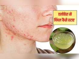 मुंहासों के लिए चेहरे पर एलोवेरा कैसे लगाएं? 99% लड़कियों को नहीं पता है लगाने का सही तरीका, अब एक्ने का हो जाएगा जड़ से खात्मा मुंहासों के लिए चेहरे पर एलोवेरा कैसे लगाएं? 99% लड़कियों को नहीं पता है लगाने का सही तरीका, अब एक्ने का हो जाएगा जड़ से खात्मा
