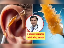 Apollo डॉक्टर ने बताएं कान का मैल हटाने के सबसे 3 सुरक्षित तरीके, 10 सेकंड में कान का पीला मैल हो जाएगा बाहर Apollo डॉक्टर ने बताएं कान का मैल हटाने के सबसे 3 सुरक्षित तरीके, 10 सेकंड में कान का पीला मैल हो जाएगा बाहर
