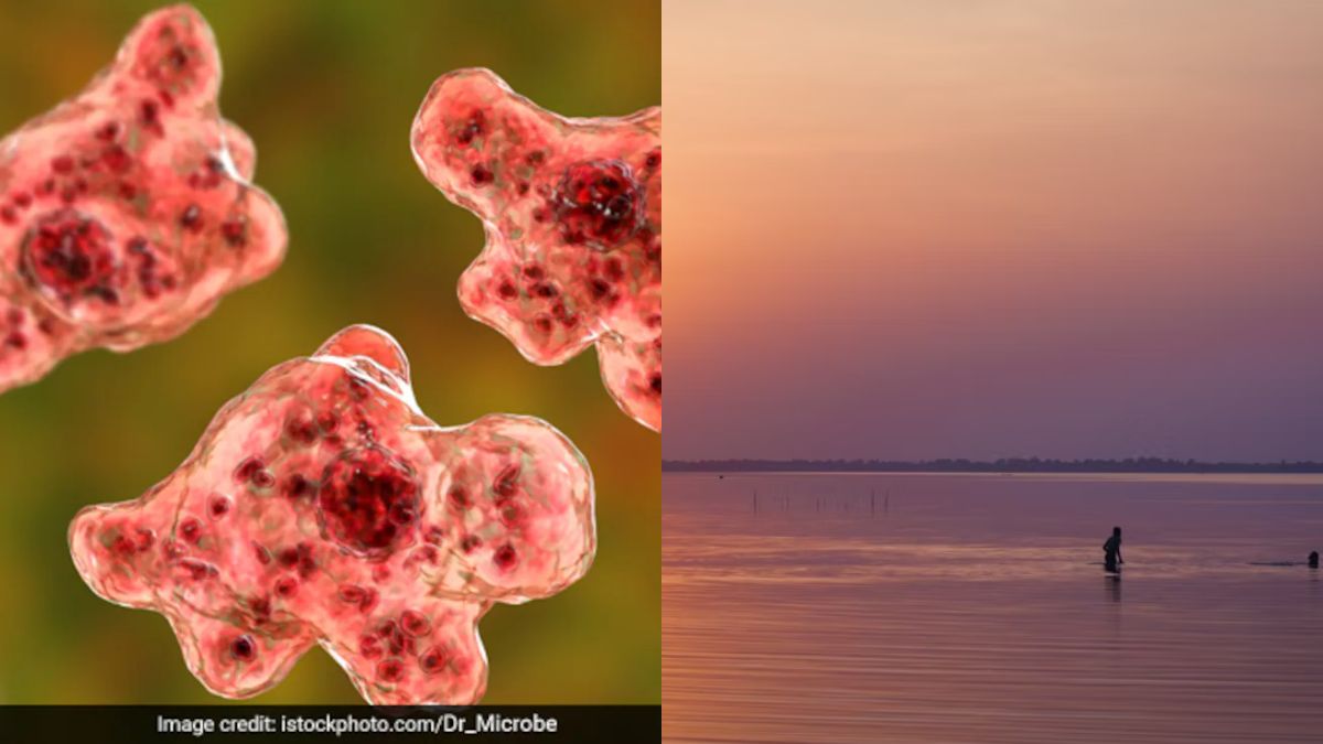 'Brain-Eating Amoeba' Kills 19 In Kerala. How It Spreads, How To Stay Safe