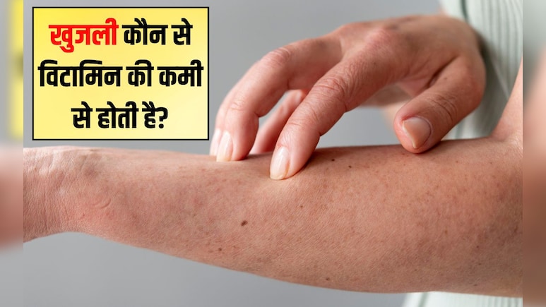 खुजली कौन से विटामिन की कमी से होती है? खुजली होने पर क्या नहीं खाना चाहिए, जान‍िए यहां