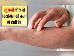 खुजली कौन से विटामिन की कमी से होती है? खुजली होने पर क्या नहीं खाना चाहिए, जानिए यहां खुजली कौन से विटामिन की कमी से होती है? खुजली होने पर क्या नहीं खाना चाहिए, जानिए यहां