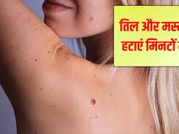 Tips and Tricks: त्‍वचा पर तिल को लेकर हैं परेशान? आजमाएं ये आसान घरेलू नुस्खे, बिना खर्च हो जाएगी ग्लोइंग स्किन