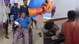 नर्मदापुरम में पागल कुत्ते का कहर: 25 लोगों को काटा, कई की हालत गंभीर; अस्पताल के फर्श पर दिखा खून ही खून