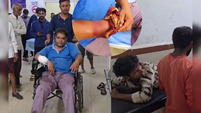 नर्मदापुरम में पागल कुत्ते का कहर: 25 लोगों को काटा, कई की हालत गंभीर; अस्पताल के फर्श पर दिखा खून ही खून