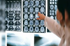 Kerala Brain Amoeba, How Serious Is The Threat? Kerala Brain Amoeba, How Serious Is The Threat?