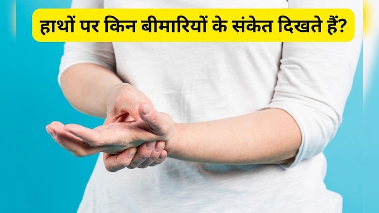 हाथों पर दिखने लगे हैं ये 7 लक्षण तो समझ जाएं किसी बीमारी का संकेत है ये, एक्सपर्ट ने चेताया हाथों पर दिखने लगे हैं ये 7 लक्षण तो समझ जाएं किसी बीमारी का संकेत है ये, एक्सपर्ट ने चेताया