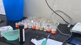NDTV Exclusive: Health For Sale? The Pathology Lab Scam of Madhya Pradesh