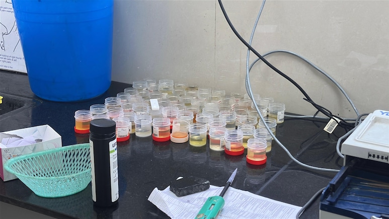 NDTV Exclusive: Madhya Pradesh Government Labs Under Scanner Over "Wrong" Test Reports NDTV Exclusive: Madhya Pradesh Government Labs Under Scanner Over "Wrong" Test Reports