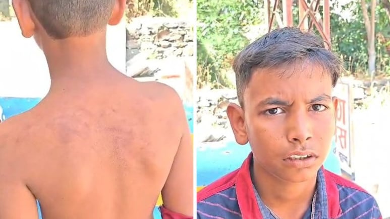 Rajasthan: उल्टी करने पर छठी के छात्र को हेडमास्टर ने पीटा, लात-जूतों से इतना मारा कि बेहोश हुआ बच्चा