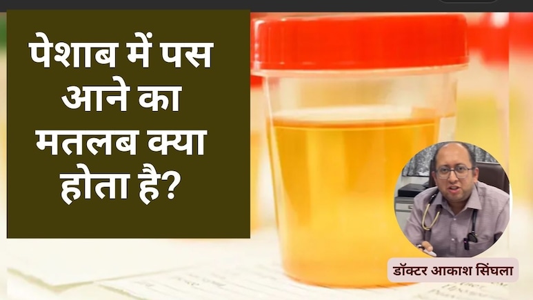 पेशाब में पस आने का क्या कारण है? Doctor ने बताया पेशाब में पस आने का घरेलू इलाज