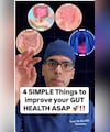 डॉक्टर सेठी से जानिए Gut Health ठीक करने 4 एकदम आसान तरीके
