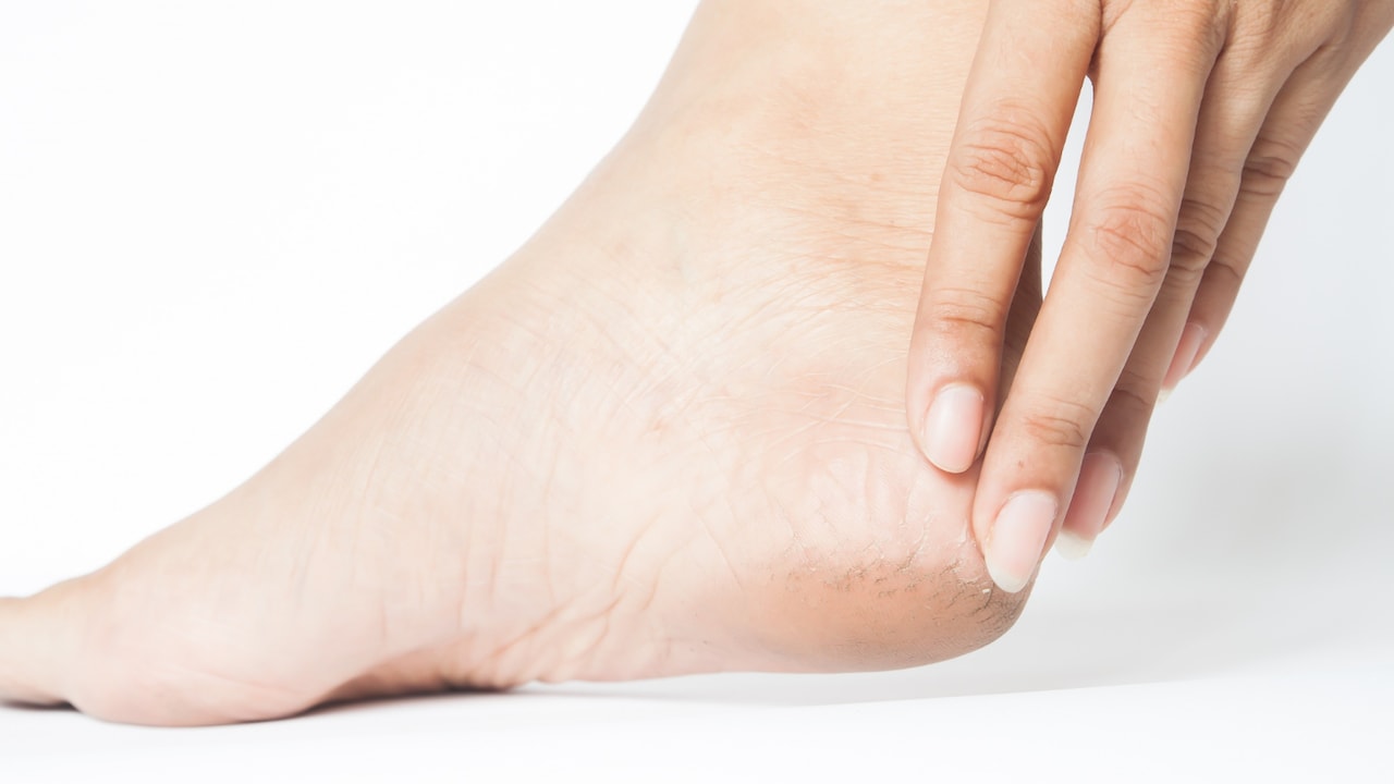 Read how to make your dry heels feel softer and smoother again