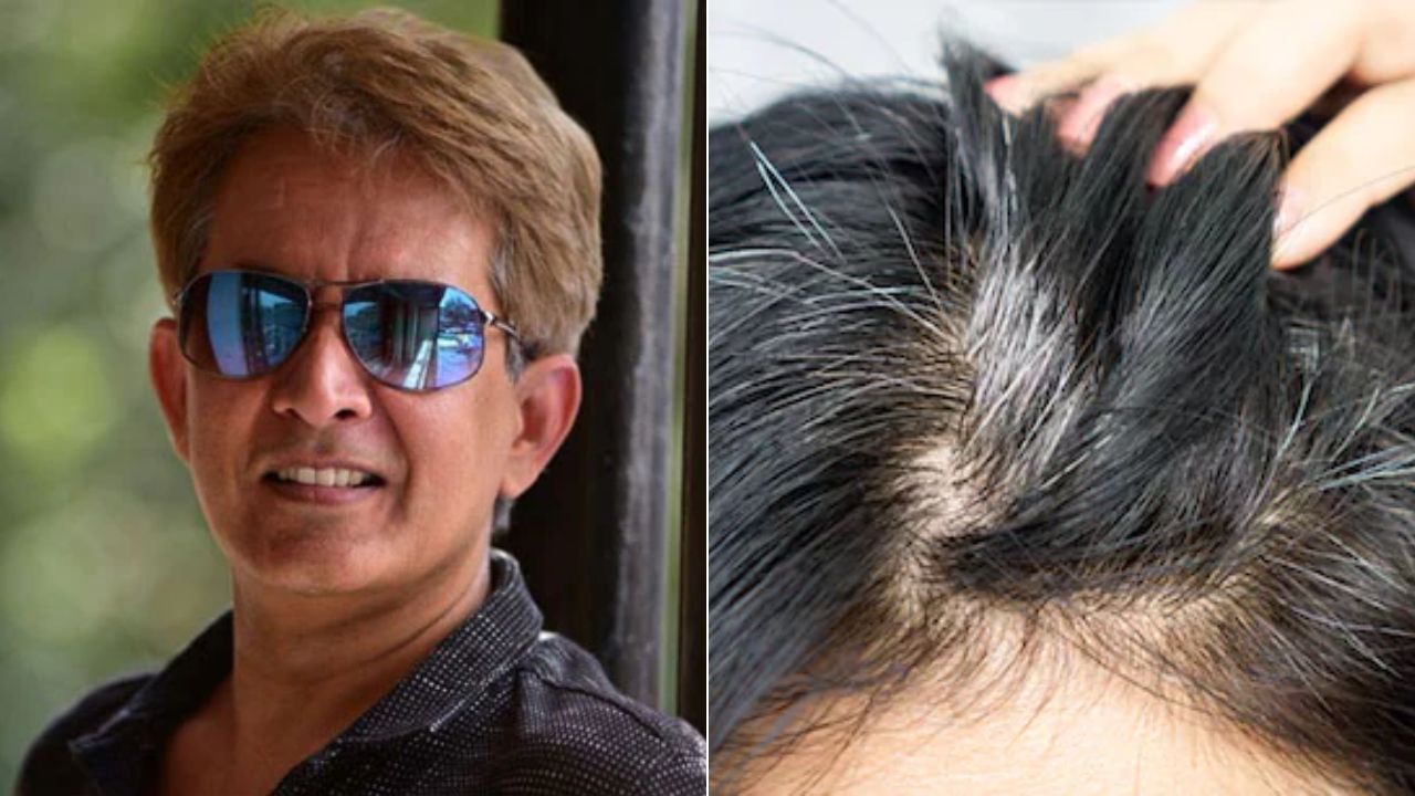 Jawed Habib ने बताया सफेद बालों का नुस्खा, इसे करने से नहीं होंगे White Hair, बाल झड़ने भी हो जाएगा कम