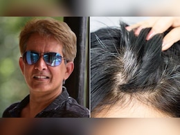 Jawed Habib ने बताया सफेद बालों का नुस्खा, इसे करने से नहीं होंगे White Hair, बाल झड़ने भी हो जाएंगे कम Jawed Habib ने बताया सफेद बालों का नुस्खा, इसे करने से नहीं होंगे White Hair, बाल झड़ने भी हो जाएंगे कम