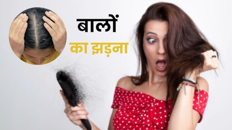 अगर आपके भी गुच्छे के गुच्छे झड़ रहे हैं बाल, तो इन बातों का रखें खास ध्यान अगर आपके भी गुच्छे के गुच्छे झड़ रहे हैं बाल, तो इन बातों का रखें खास ध्यान