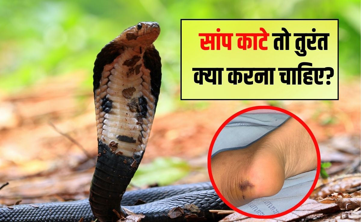 सांप काटे तो तुरंत क्या करना चाहिए? कैसे पता चलेगा कि सांप ने काटा है, जान‍िए यहां पर