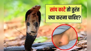 सांप काट ले तो क्या पानी पी सकते हैं? 3 दिन बाद भी दिखते हैं लक्षण! डॉक्टर से जानें तुरंत क्या करें और क्या नह