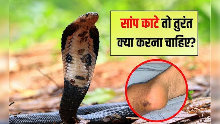 सांप काटे तो तुरंत क्या करना चाहिए? कैसे पता चलेगा कि सांप ने काटा है, जान‍िए यहां पर