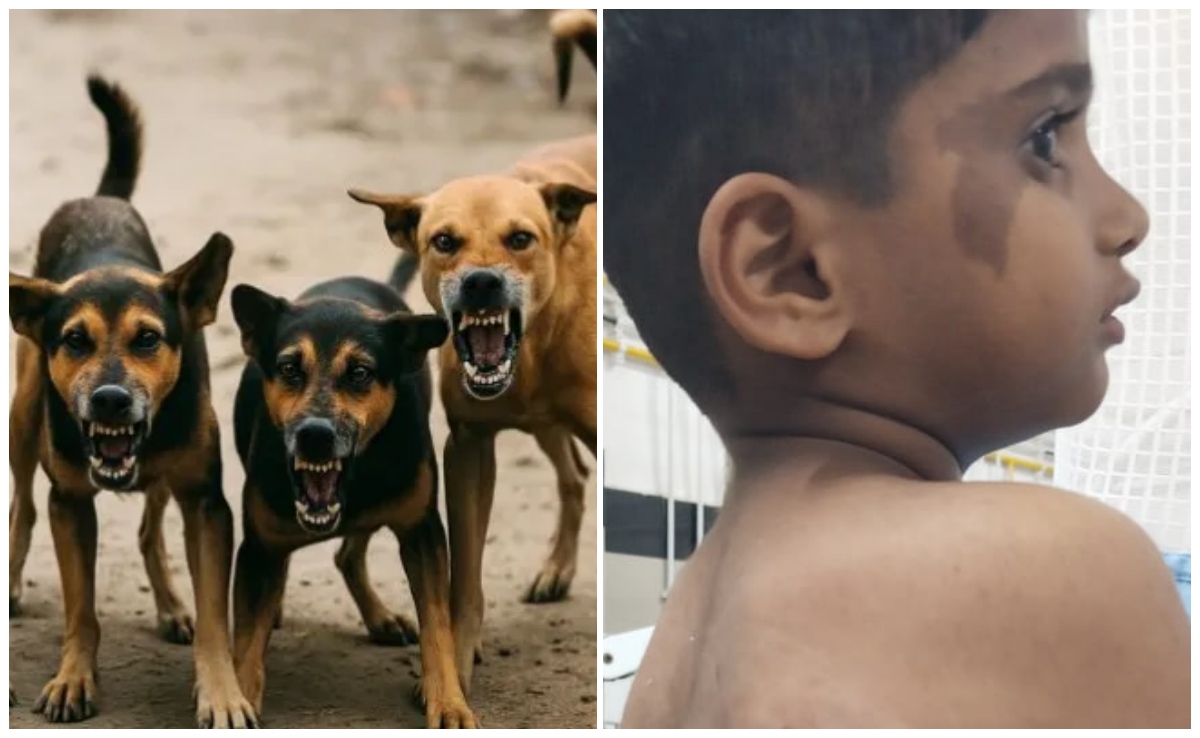 महिला का मुंह नोंचा, बच्‍चे की पीठ... कर्नाटक में आवारा कुत्‍तों की दहशत