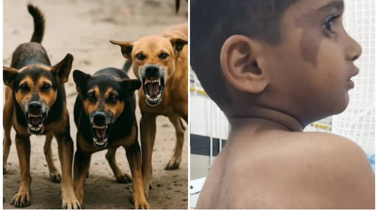 महिला का मुंह नोंचा, बच्चे की पीठ... कर्नाटक में आवारा कुत्तों की दहशत महिला का मुंह नोंचा, बच्चे की पीठ... कर्नाटक में आवारा कुत्तों की दहशत