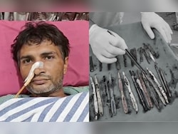 Family Sent UP Man To Rehab. He Got Addicted To Eating Spoons, Toothbrushes