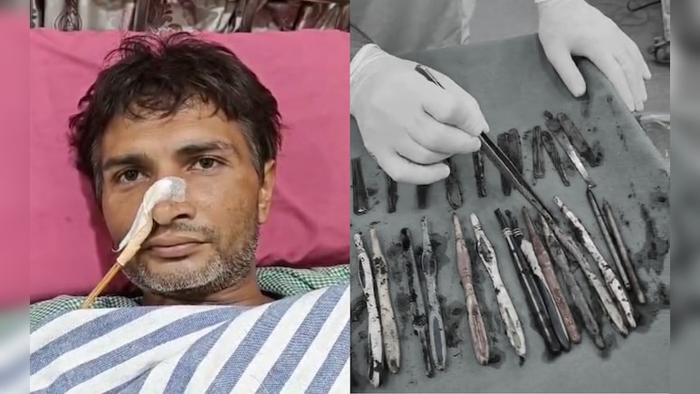 Family Sent UP Man To Rehab. He Got Addicted To Eating Spoons, Toothbrushes