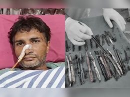 Family Sent UP Man To Rehab. He Got Addicted To Eating Spoons, Toothbrushes Family Sent UP Man To Rehab. He Got Addicted To Eating Spoons, Toothbrushes
