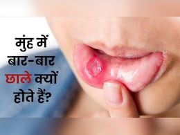 किस विटामिन की कमी से होते हैं छाले? ये खाएंगे तो सुबह तक हो जाएंगे छूमंतर किस विटामिन की कमी से होते हैं छाले? ये खाएंगे तो सुबह तक हो जाएंगे छूमंतर